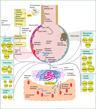 Pathogenesis of Idiopathic Pulmonary Fibrosis